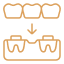 dental bridge