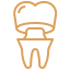 dental crown